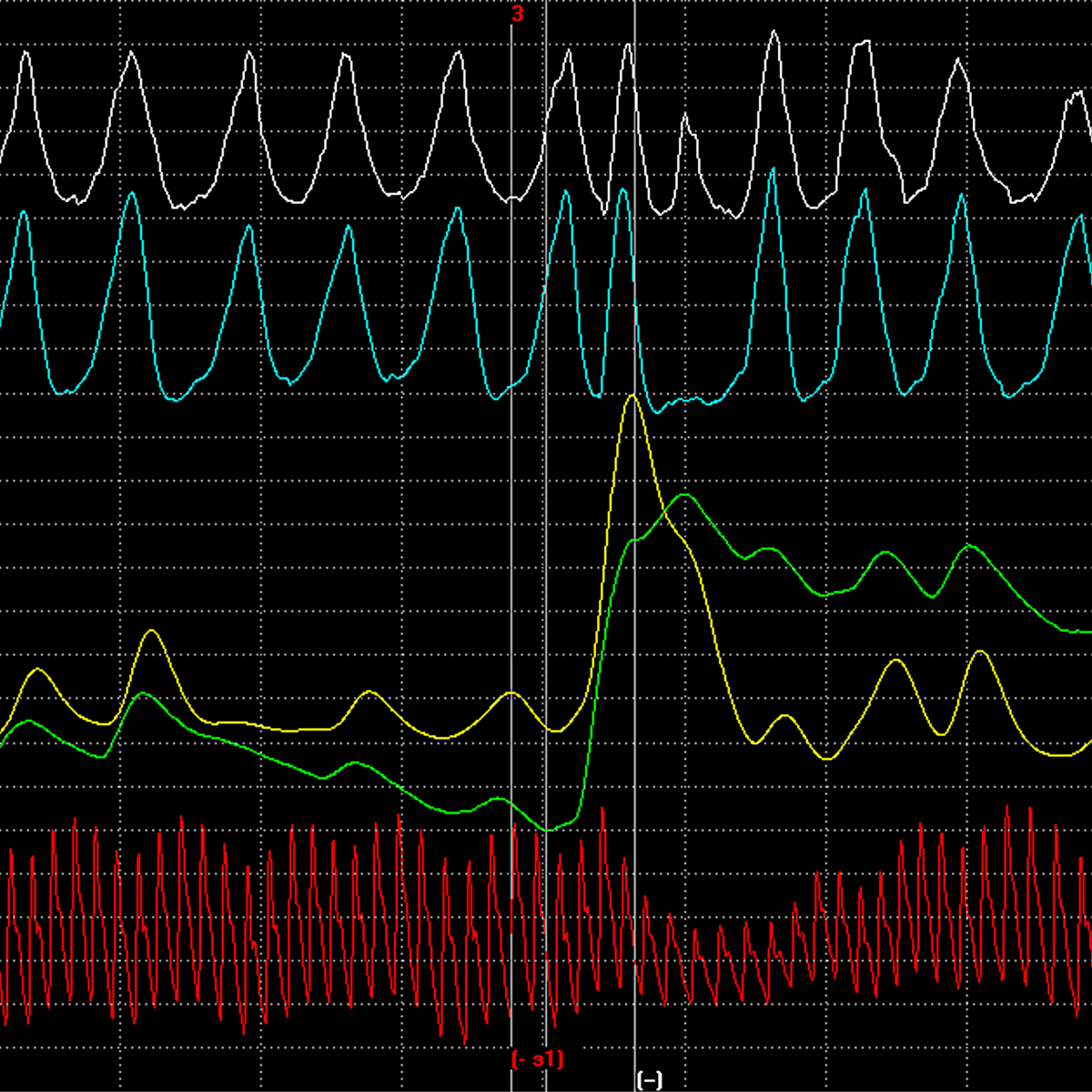 5ab9935750510c700ad6db813a7377423a8e9d04d0b7174cdf288227a6cb1244.image.png